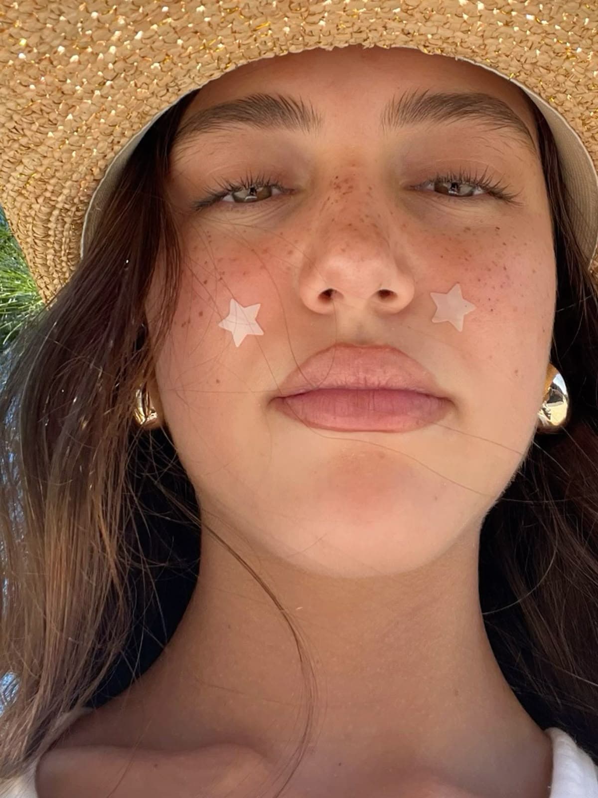 Your PCOS skin pigmentation game plan that works