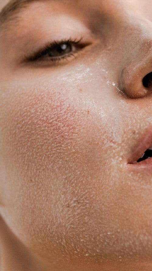 Why your dry skin needs more than heavy moisturizer